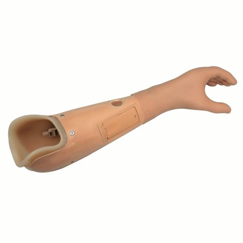 Trans Radial Prosthesis